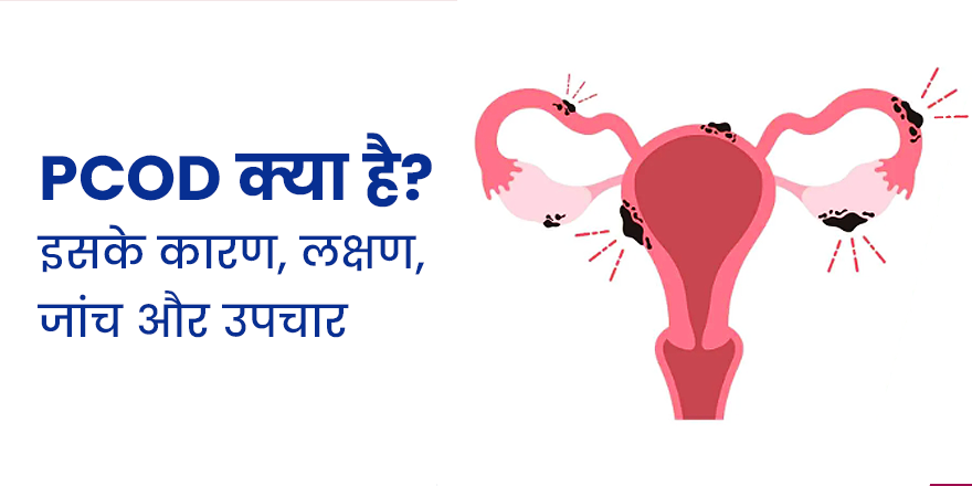 PCOD क्या है? इसके कारण, लक्षण, जांच और उपचार